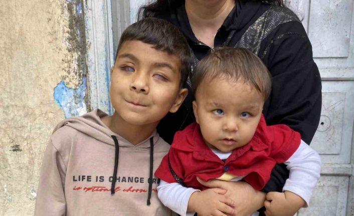 Tedaviyle dünyanın renklerini ilk defa gören 2 kardeş, başka hastalara da umut oldu