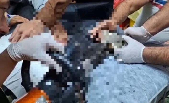 Tel Abyad’ta elini kıyma makinesine kaptıran çocuk Şanlıurfa’da tedavi altına alındı