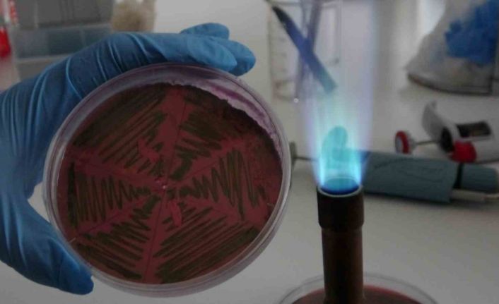 Çiğ süt, gıdayla bulaşan idrar yolu enfeksiyonlarına kapı açıyor