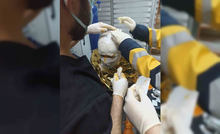 Erzincan’da kömür ocağında yangın: 2 işçi yaralı