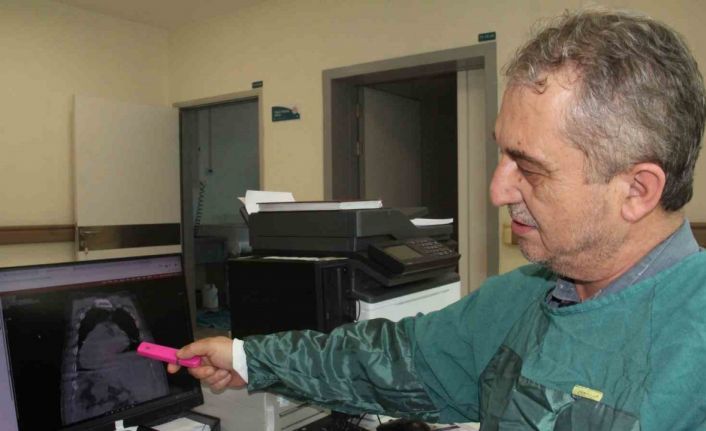 Giresun’dan tıp literatürüne yeni bir yaklaşım: "Karadeniz PEG Kuralı"