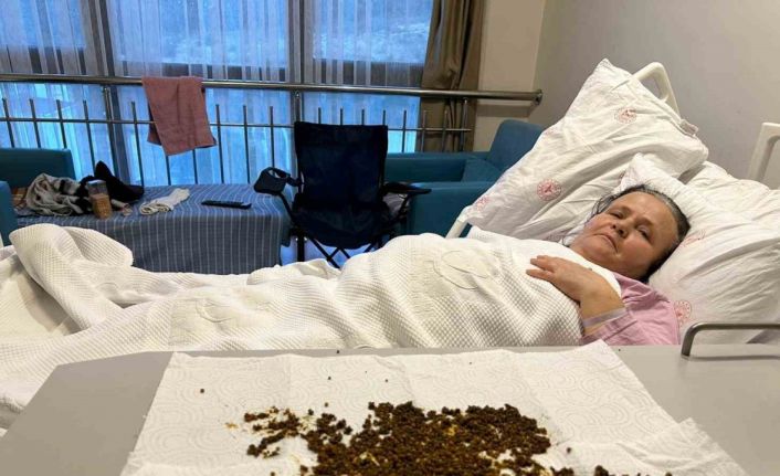 Hastadan çıkan taşları sayamadılar