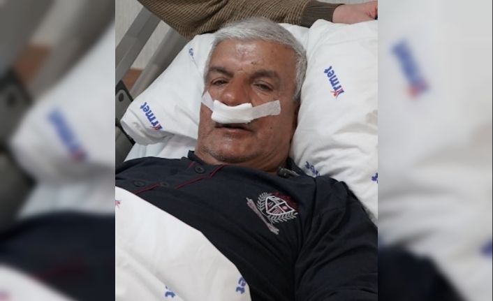 65 yaşındaki adamın burnundan 100 gramlık taş çıkarıldı