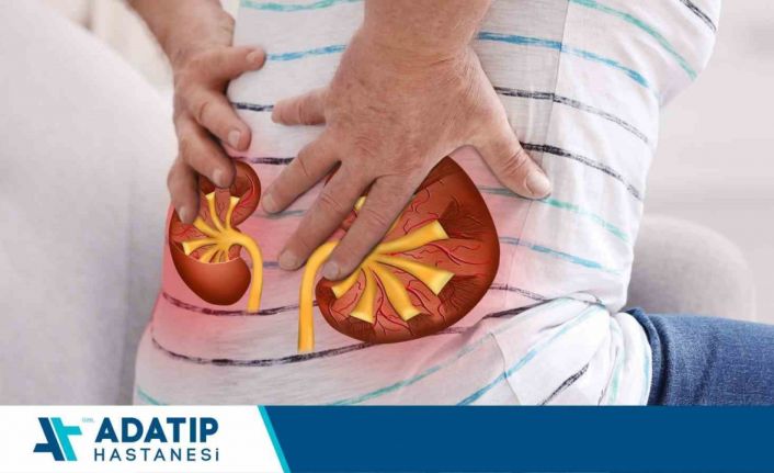 Böbrek taşı vakalarında kişiye özel tedavi