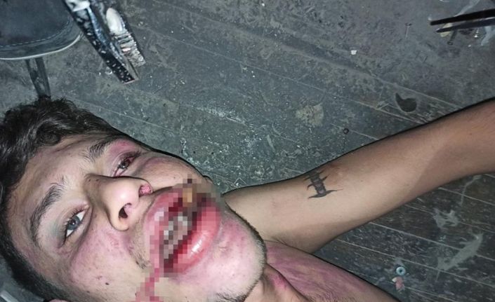 Hamam böceği yedirilen gencin dosyasında karar: Yağmadan beraat, hürriyeti tehditten 6 yıl 12 ay ceza