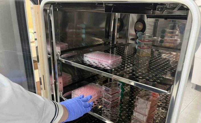 Parkinson’da bağırsak- beyin iletişimi çip üstü organ teknolojisiyle araştırılıyor