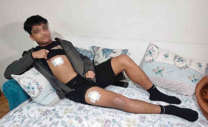 Akran zorbalığı az kalsın öldürüyordu: Önce dövüldü sonra bıçaklandı