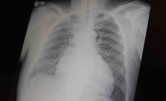 Profesör açıkladı: "Metamfetamin ve kokain gençler arasında tehlikeli boyutlara ulaştı"