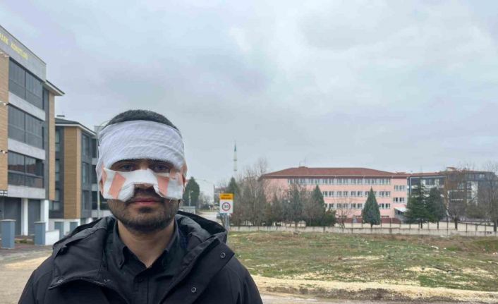 Rehber öğretmenin yüzüne sıcak çay fırlattığı fizik öğretmeni feci şekilde yandı