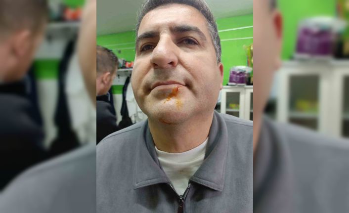 Zonguldak’ta 3. Lig maçı sonrası gerginlik: 2 gazeteci darbedildi, 2 polis yaralandı