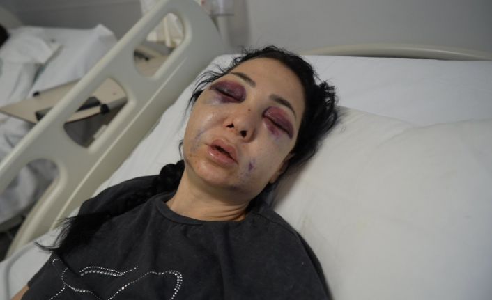 Anne ve oğlunun darp edilmesine ilişkin gözaltına alınan 3 şüpheliden 1’i tutuklandı