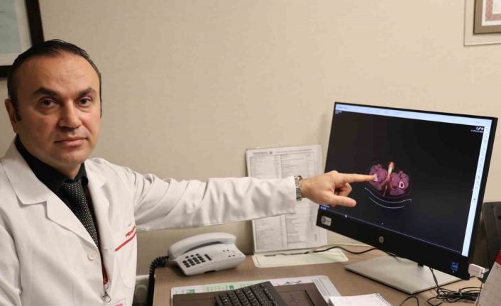 Dünyada şu ana kadar 60 kişide olan bu vakanın sonuncusu Diyarbakır’da görüldü