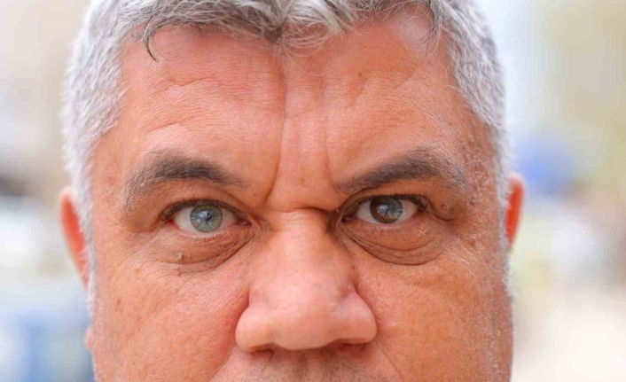 Kahramanmaraşlı adam 3 renkli gözleriyle görenlerin ilgisini çekiyor