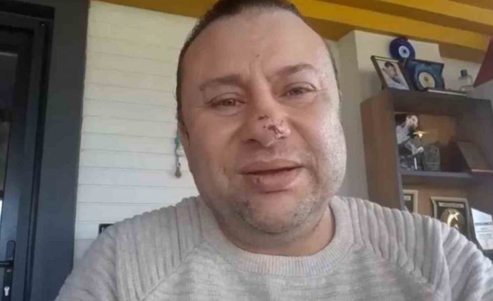 Pitbull saldırısına uğrayan Onur Akay o anları anlattı: "Ben ölümden döndüm"