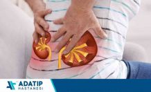 Böbrek taşı vakalarında kişiye özel tedavi