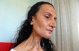 Dil kanserine yakalandı, hayatları karardı