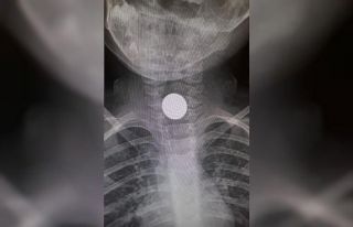 1 TL hastanelik etti