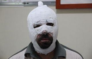 Ardahan’da ki taş ocağında dehşeti yaşayan...