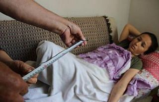 Böbreğinde unutuldu! 10 yıl sonra fark edildi