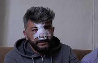 Yaralanan kişinin kendi oğlu olduğunu duyunca şoka...
