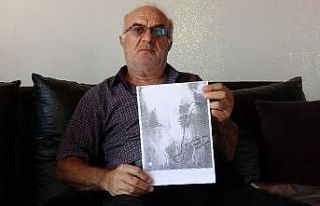 Ameliyatla vücuda 3 aylığına takılıp unutulan...