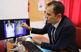 19 yaşındaki Onur 10 saatlik skolyoz ameliyatıyla...