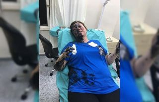 İş kadınını darp edip, yanıcı madde döken...