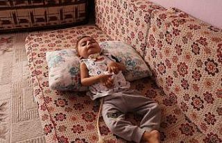 Küçücük bedeni ile yaşam savaşı veriyor