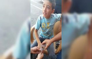 Küçük çocuğun parmağına sıkışan yüzüğü...
