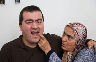 Zihinsel engeli Tayfun üç aydır diş ağrısı...