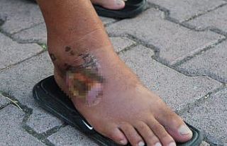 Aslan balığının zehirlediği balıkçı: "Bir...