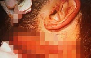 Doktoru boğazından jiletle yaralayan zanlı tutuklandı