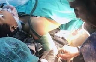 Elini kıyma makinesine kaptıran çocuğa müdahale