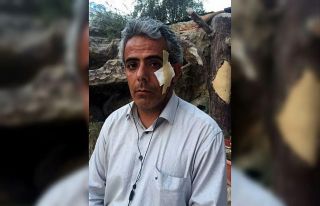 İHA muhabiri yaralandığı roketli saldırıyı...