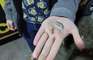 İşitme cihazını kaybeden anne, tekrar duymak istiyor