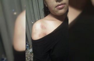 Şiddete uğradığını iddia eden Nepalli genç...