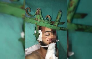 Antalya’da gencin yüzüne saplanan demir çubuk...