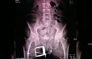 İranlı kadının şok eden uyuşturucu taşıma...