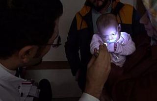 Parmak bebeğe ışığı gösteren operasyon