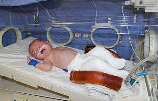 Kuzey bebeğe kuvözde alçı tedavisi