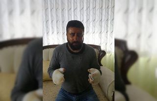 Elektrik çarpması sonucu ağır yaralanan vatandaş...