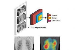 Korona virüs teşhisini kolaylaştıracak yapay zeka...