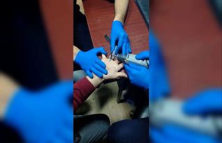 Parmağa sıkışan yüzük kesilerek çıkarıldı