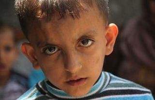 Kalbi delik Suriyeli çocuğun dramı