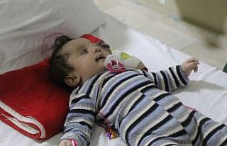 Suriyeli Yusuf bebek Türkiye’de tedavi ediliyor