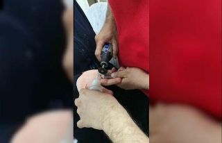 Kadının parmağındaki yüzük kesilerek çıkartıldı
