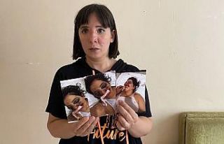 (Özel) ATV kazasında gözünü kaybeden genç kadın...