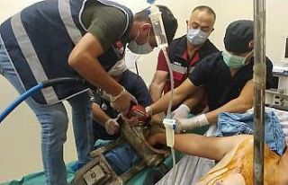 Eli salça makinasına sıkışan genç için doktorlar...