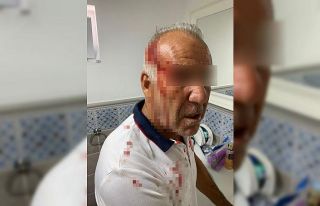 ’Siz kiracısınız, bu yolu kullanmayın’ kavgası...