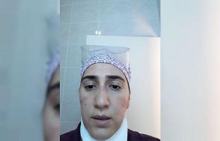 24 saat maske ve gözlükle hastalara baktı, yüzünde...
